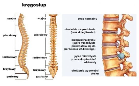 Studio terapii bólu kręgosłupa zaprasza :: Wiadomości :: Jaslo4u.pl
